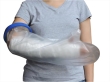 Arm Cast Cover